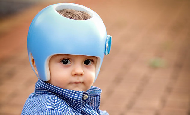 Ação contra plano de saúde órtese craniana